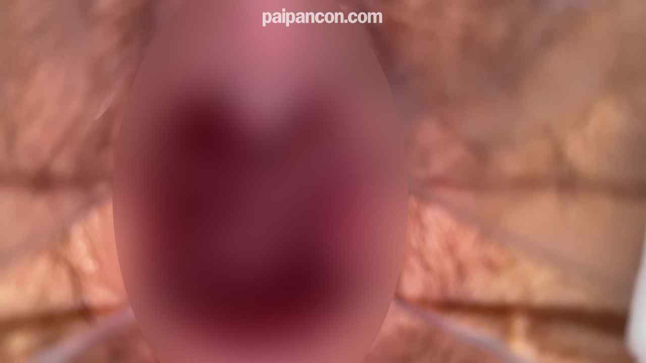 FC2-PPV-4585708 - CP0320 あどけないのにアナルのパクパクが凄い美女のイキまくり中出しファック ♥クスコ♥鬼接写♥ thumbnail_9.jpg